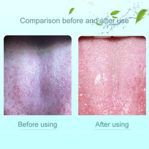 1 Piece Tongue Scraper | Tongue Cleaner | Double Head Tongue Cleaner | Reduce Bad Breath (random color) - Image 4