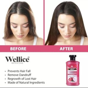 Wellice Onion Anti Hair Loss Oil - 150ml - Image 5