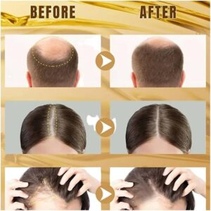Wellice Onion Anti Hair Loss Oil - 150ml - Image 6