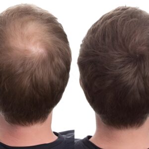 CABOKI HAIR BUILDING FIBERS - 25g - Image 11