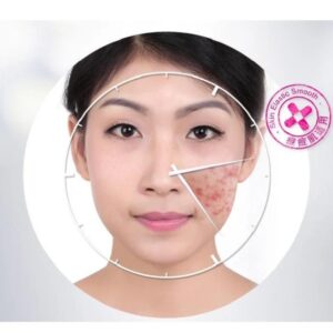 BIOAQUA Anti Acne Cream Acne Scar Removal Cream - Image 2