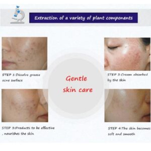 BIOAQUA Anti Acne Cream Acne Scar Removal Cream - Image 6
