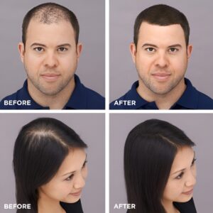 Toppik Hair Building Fiber Fuller Looking Hair for Men & Women (27.5g) - Image 9