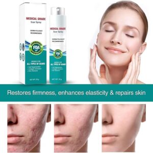 Scar Remove,Scar Remove Medical Grade Scar Spray,Medical Grade Scar Removal Spray,Scar Removal Spray,Scar Remove Spray,Scar Spray,Advanced Acne Scar Treatment for Face (1Pcs) - Image 7