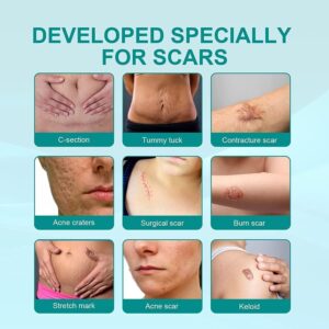 Scar Remove,Scar Remove Medical Grade Scar Spray,Medical Grade Scar Removal Spray,Scar Removal Spray,Scar Remove Spray,Scar Spray,Advanced Acne Scar Treatment for Face (1Pcs) - Image 5