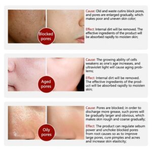 Rorec Moisturizing Anti Wrinkle Rice Face Serum for Open Pores 15ml - Image 3
