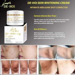 DE HOI Skin Whitening Cream – Brightening & Moisturizing Face and Body Cream for Dark Skin - 75 gram - Image 5
