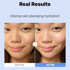COSRX Pure Sodium Hyaluronic Acid 3% Serum, Hydration & Moisture Boosting Facial Serum for Fine Lines & Wrinkles, Plump & Repair Dry Skin 20ml - Image 6