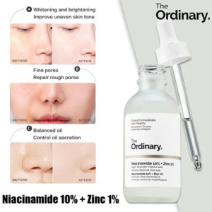 The Ordinary Niacinamide Serum 10% + Zinc 1% Supersize Serum [Buy 1 Get 1 Free] | Best Quality Serum 30ML - Image 3