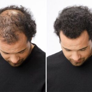 Toppik Hair Building Fiber | Pack of 3 Toppik Hair Fiber ( 27.5g ) + Applicator + Comb - Image 3