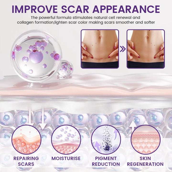 Timilk Regenscar Stem Cell Scar Gel 20g Triple Action Formula For Old And New Scars Surgical Marks Skin Renewal - Image 4