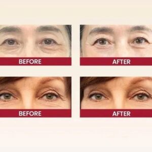 K-SECRET SEOUL 1988 Eye Cream: Retinal Liposome 2% + Fermented Black Bean – Advanced Anti-Aging & Brightening Formula - 30ml - Image 3